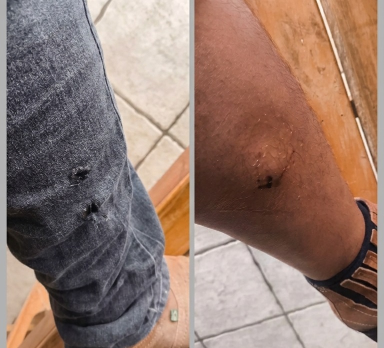 Homem é mordido por cachorro solto na rua Santa Rita, no centro de Presidente Olegário